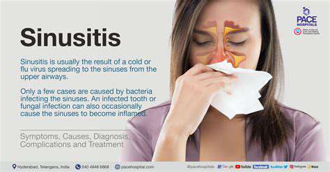 CausesofSinusitis