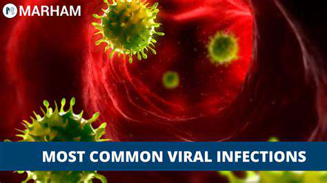 CommonViralInfections