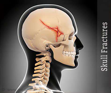 IdentifyingSkullPainSymptoms