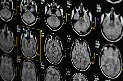 AnalyzingMRIScansforHeadaches